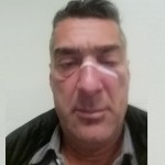 padre picchiato